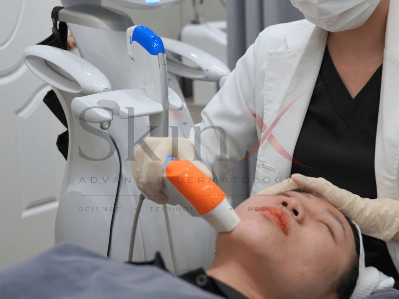 Công nghệ trẻ hóa tầng sâu giảm mỡ nọng hiệu quả 